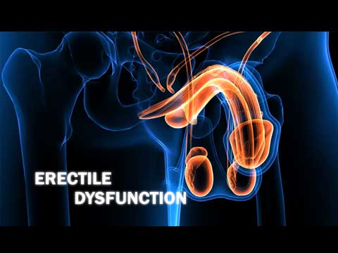 Disfunção erétil