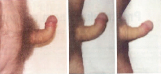 IPP